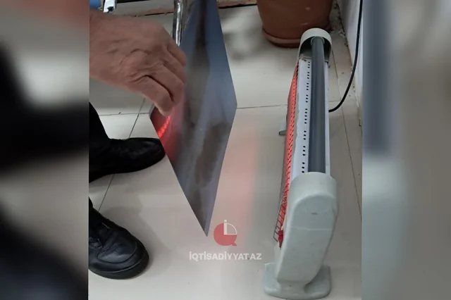Bakıda poliklinikada rentgen plyonkası elektrik plitəsi ilə qurudulub