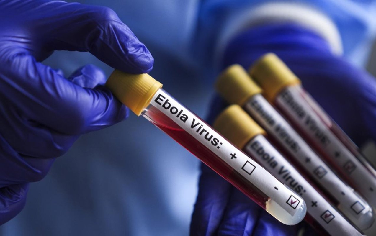 Ebolaya yoluxanların yarısı ölüb